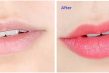 Hình ảnh trước và sau khi phun môi